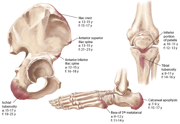 overuse injuries in young