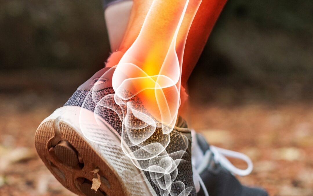 Recovering from an Ankle Injury: A Physio’s Guide Through Each Stage
